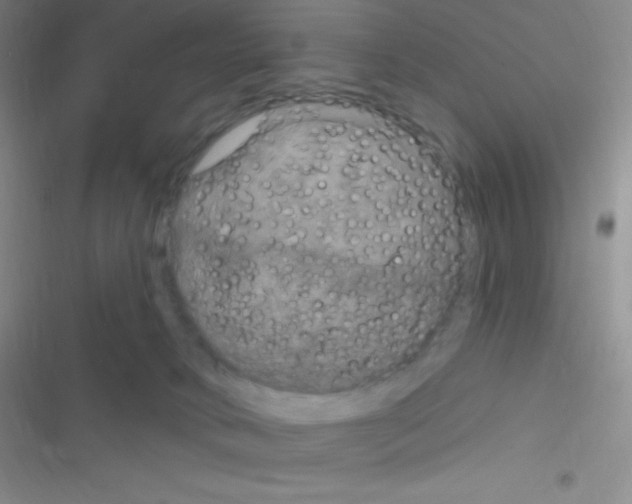 X0000116590034201001211335