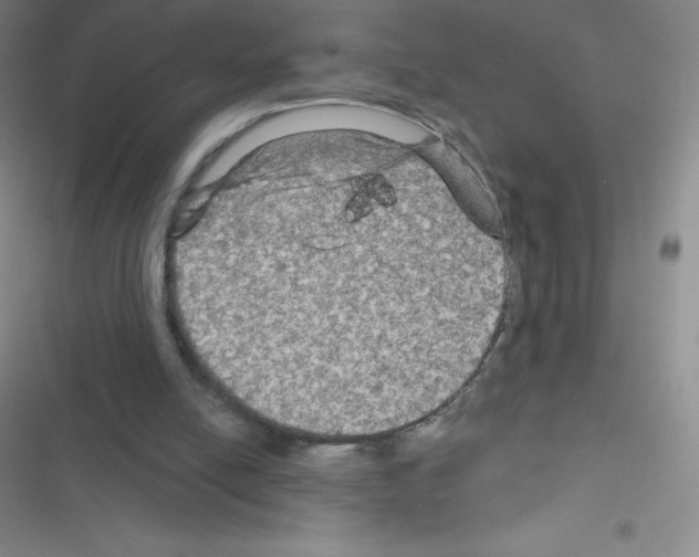 X0000116590054201001211334