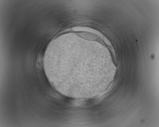 X0000116590094201001211335