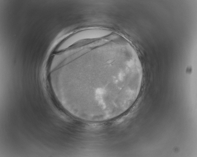 X0000116590198201001211333