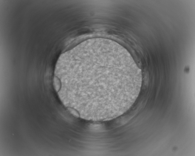 X0000116590283201001211332