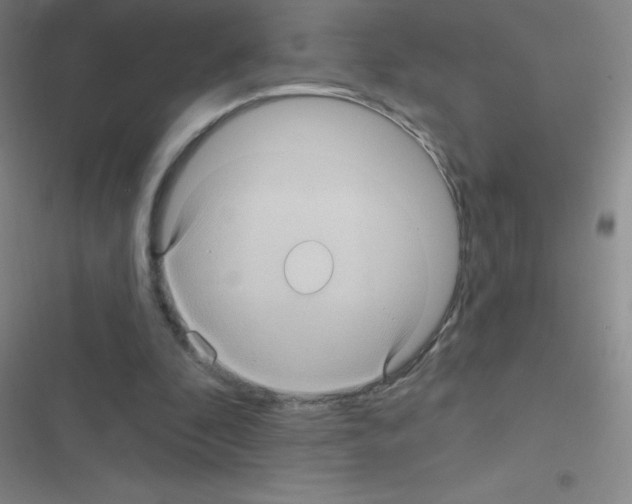 X0000116590296201001211332