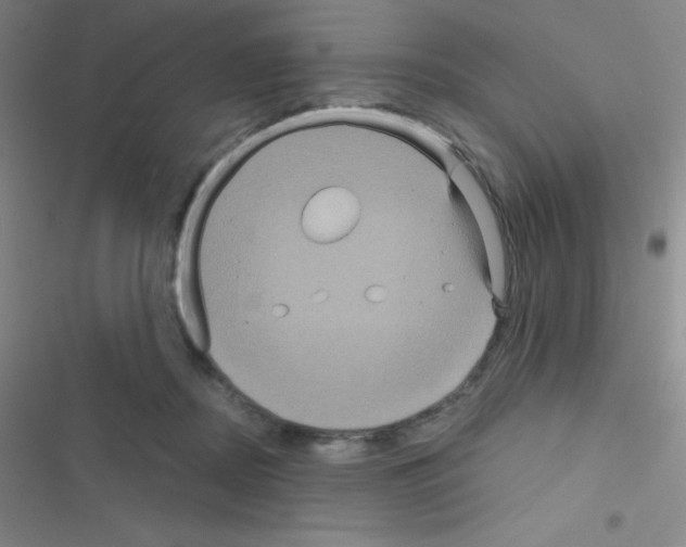 X0000116590362201001211331