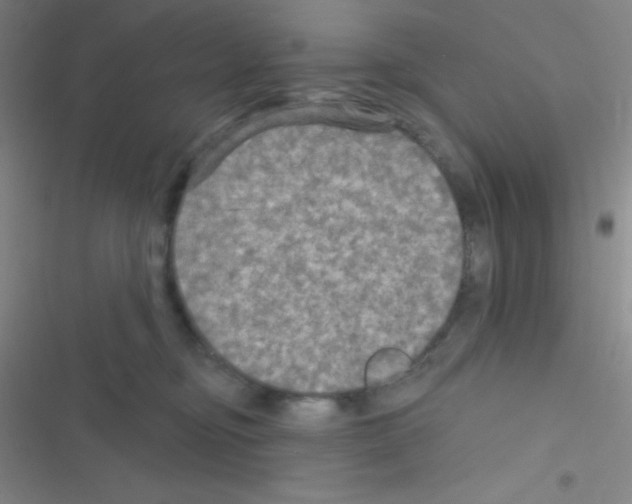 X0000116590374201001211331