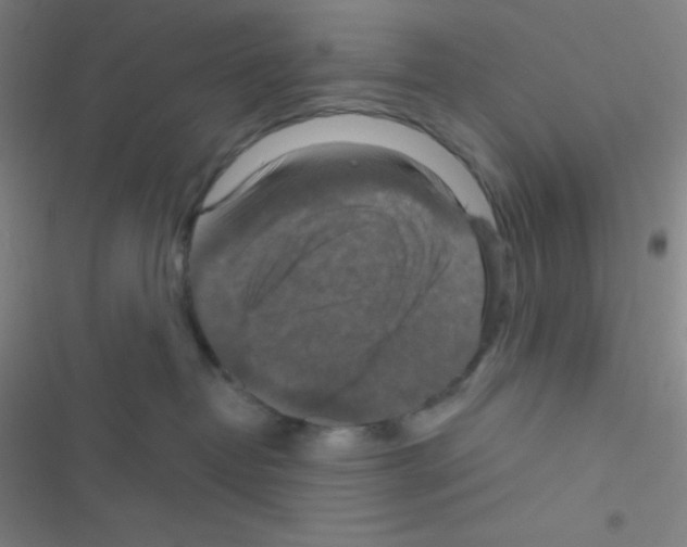 X0000116590382201001211331