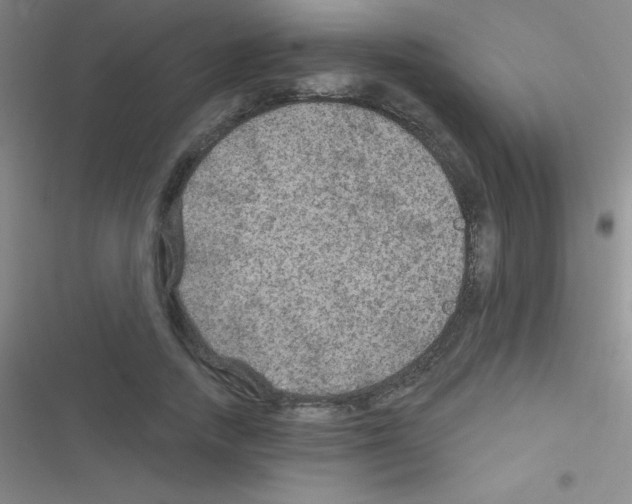 X0000116590738201001211325