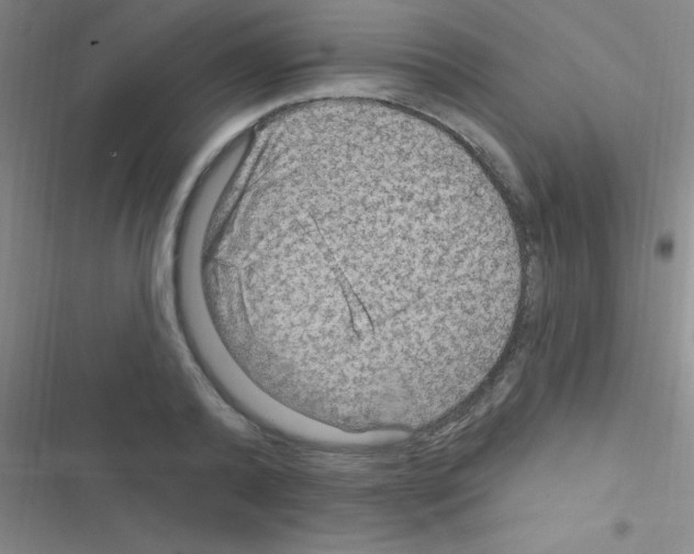 X0000116590792201001211325