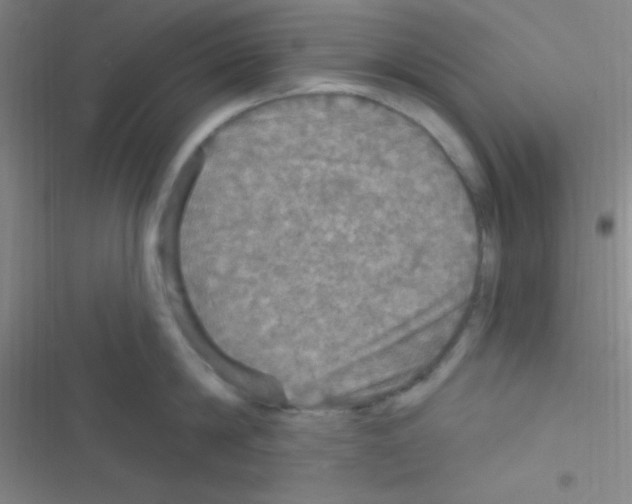 X0000116590814201001211325