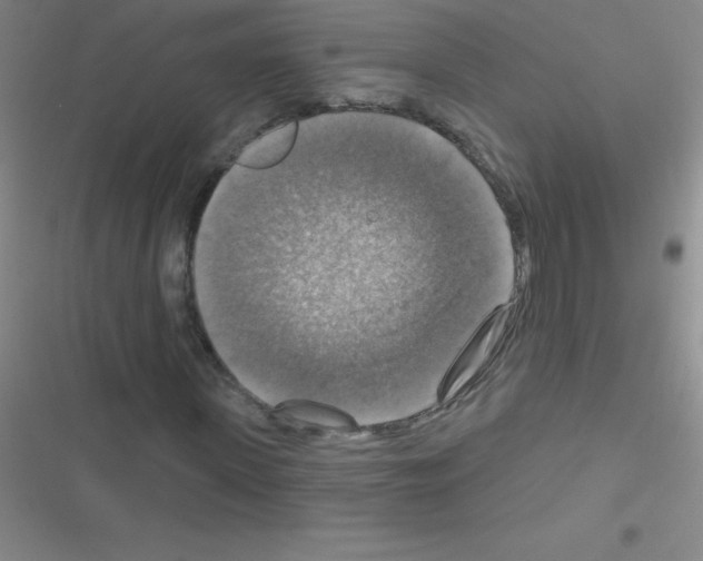 X0000116590915201001211323