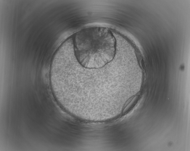 X0000116590937201001211323