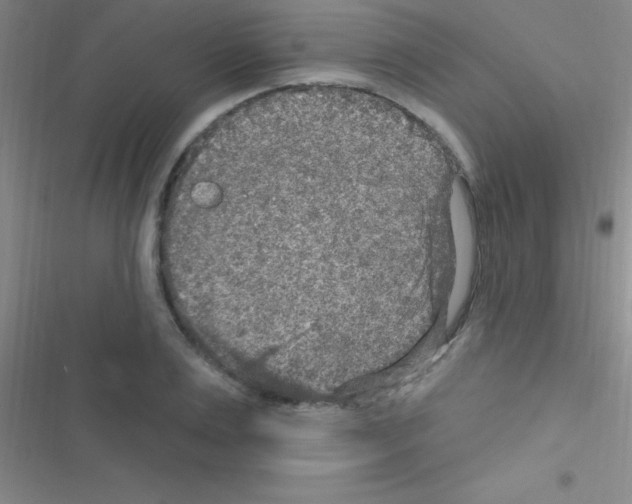 X0000116590983201001211322