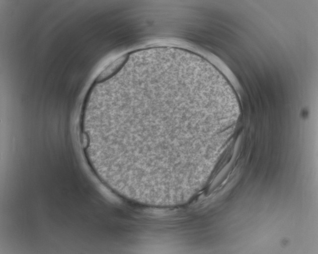 X0000116591005201001211322