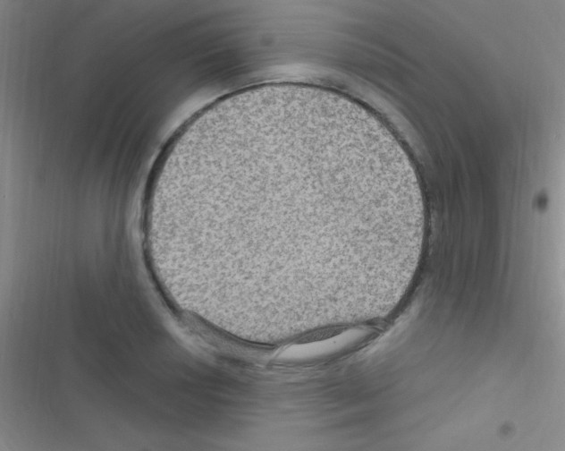 X0000116591034201001211322