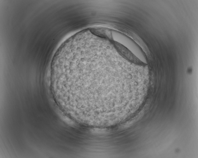 X0000116591036201001211322