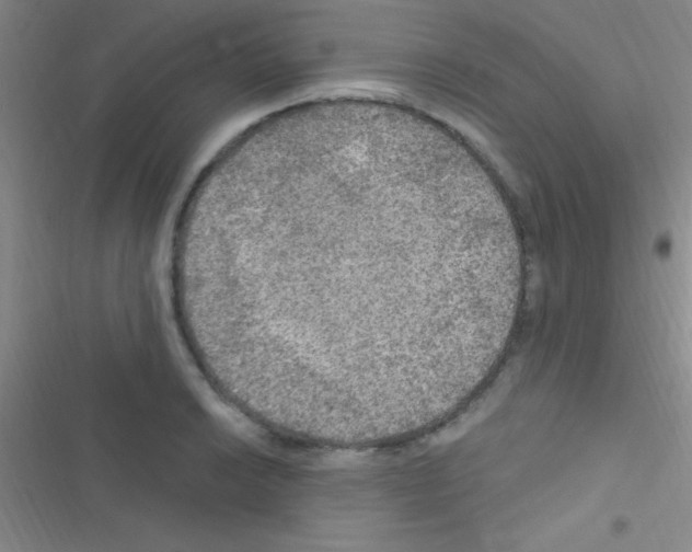 X0000116591038201001211322