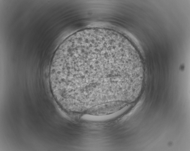 X0000116591041201001211322