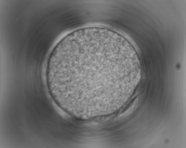 X0000116591054201001211322