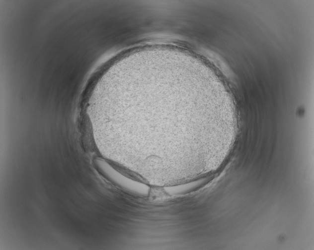 X0000116591164201001211320