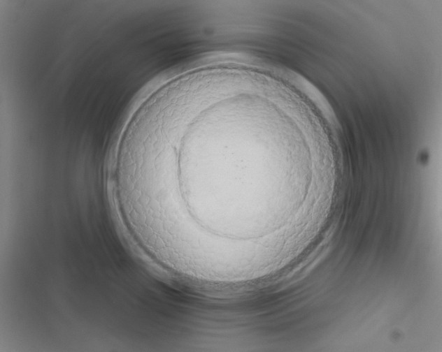 X0000116591338201001211318