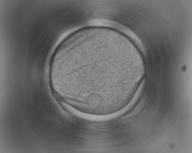 X0000116591376201001211317