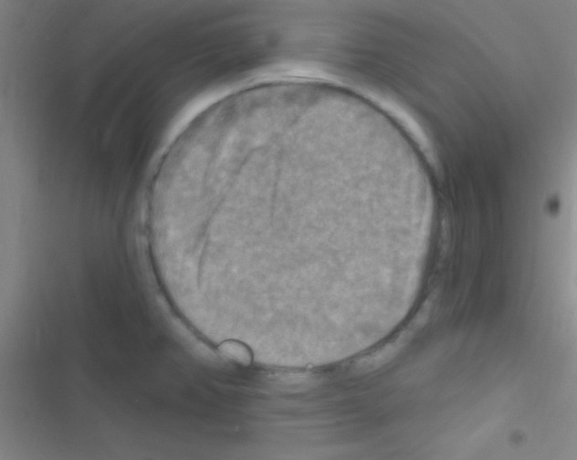 X0000116591382201001211317