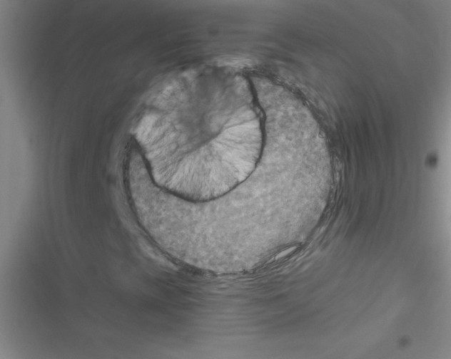 X0000116591393201001211316