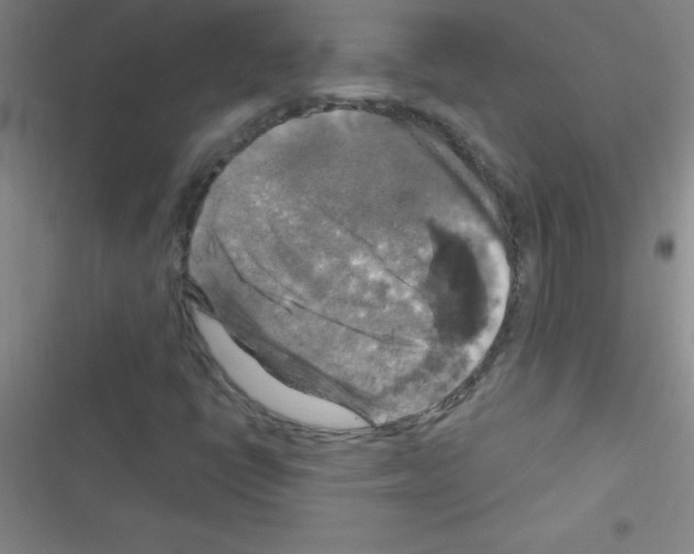 X0000116591398201001211316