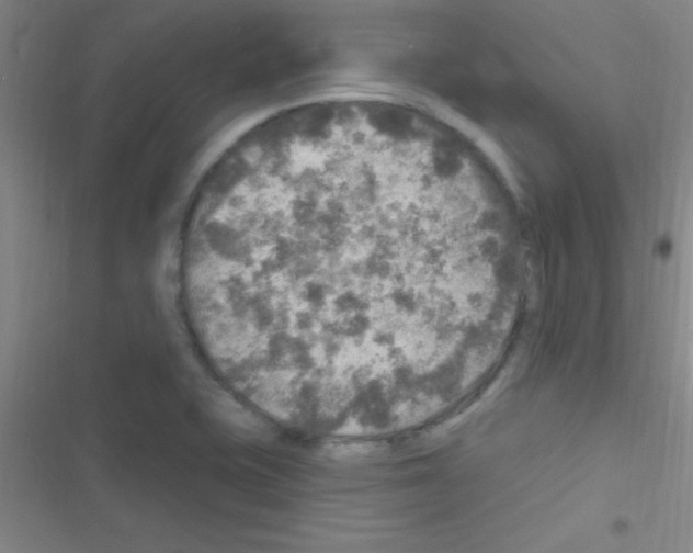 X0000116591415201001211316