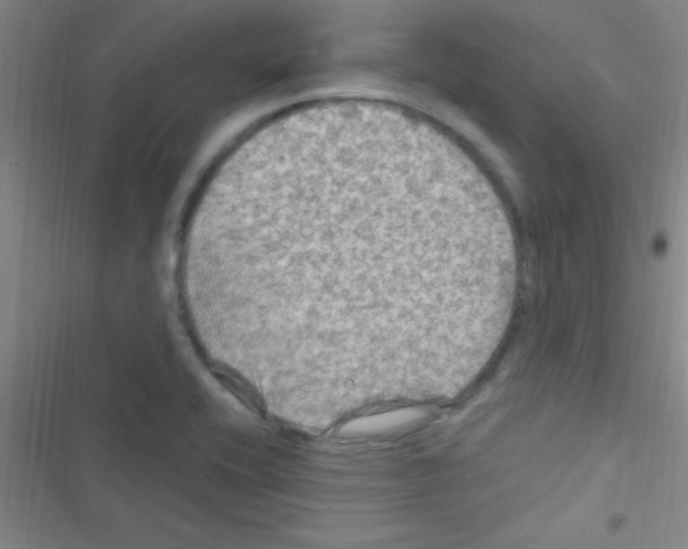 X0000116591416201001211316