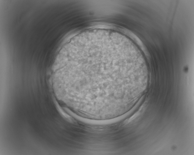 X0000116591433201001211317