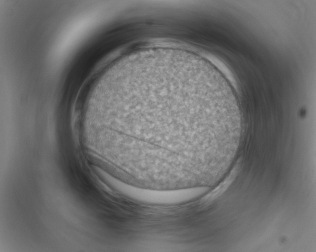 X0000116591438201001211317