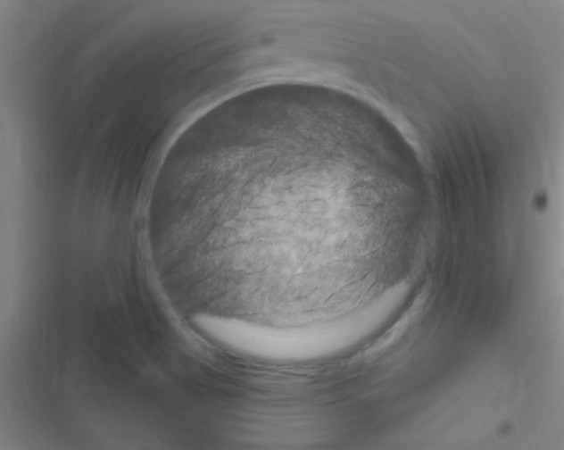 X0000116591513201001211315