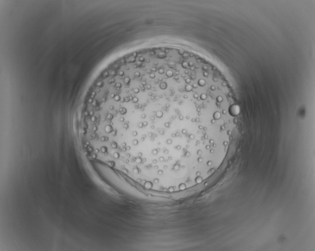 X0000116591515201001211315