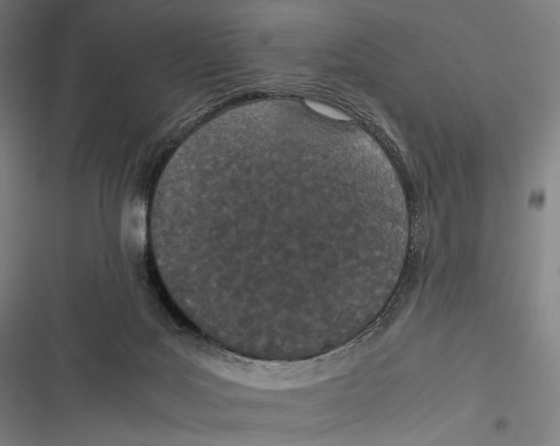 X0000116600027201001081159