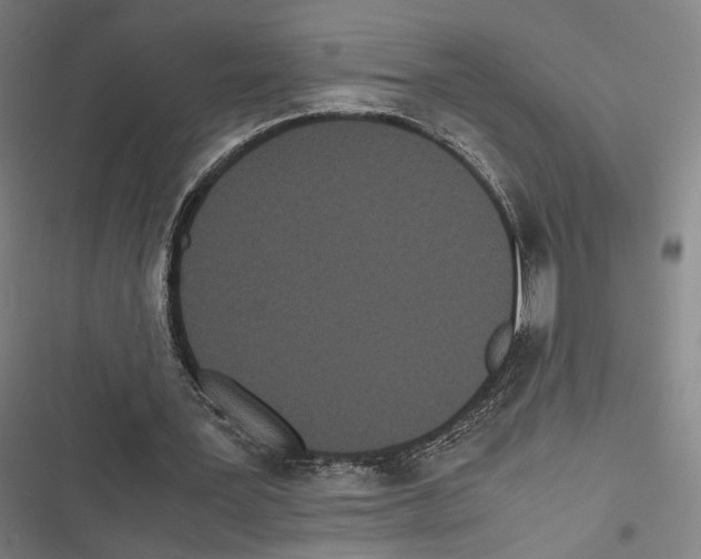 X0000116600387201001081154