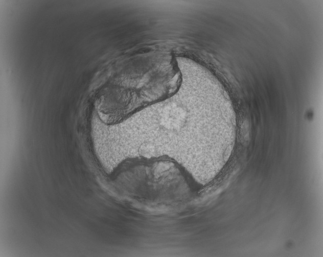 X0000116600913201001221254