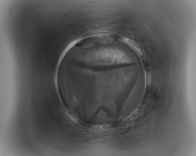 X0000116610147200912181213