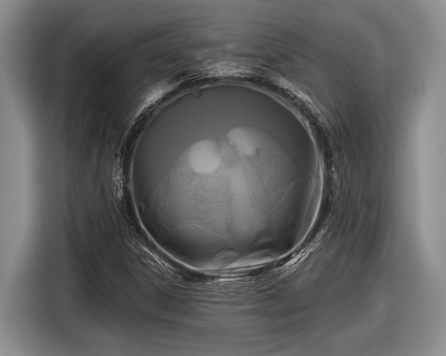 X0000116611306200912181158