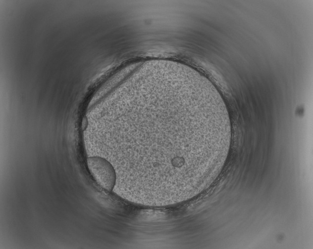 X0000116610354201001081215