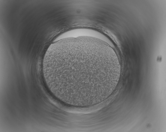 X0000116610017201001221328