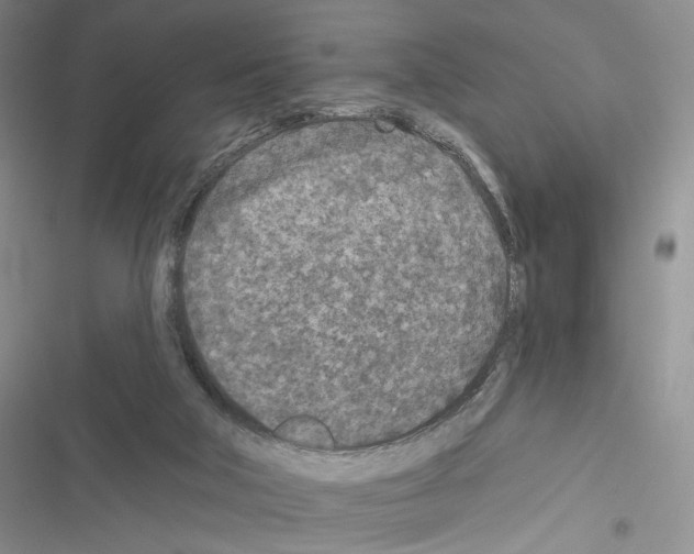 X0000116610018201001221328