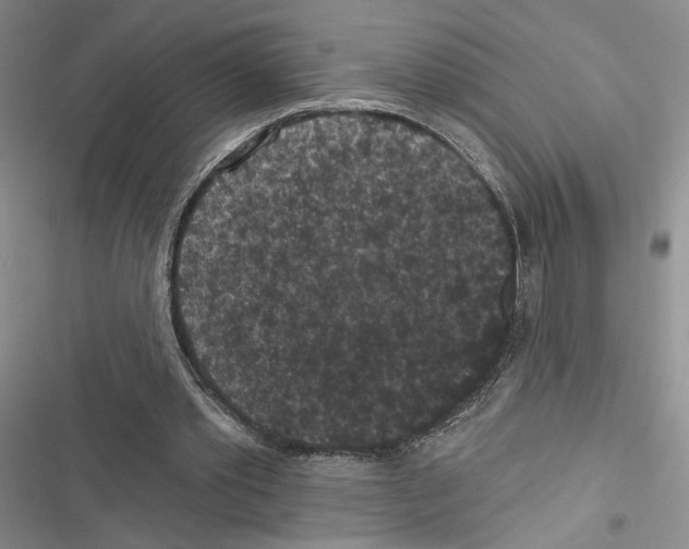 X0000116610389201001221323