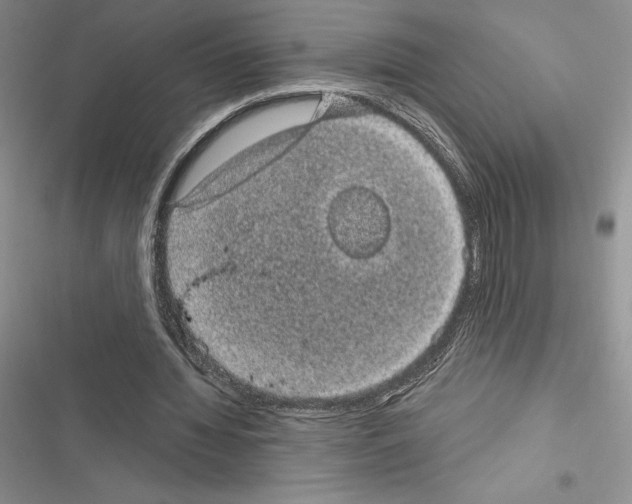 X0000116610436201001221322