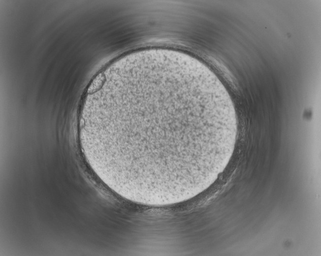 X0000116610888201001221316