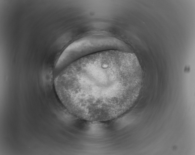 X0000116620336201001081237