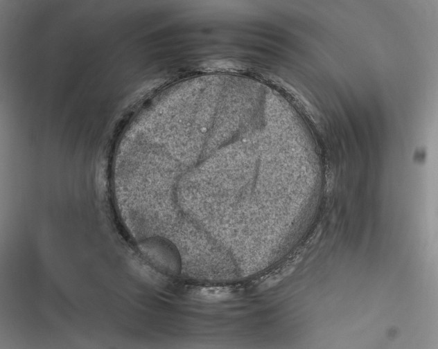 X0000116620353201001081236