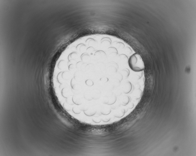 X0000116620638201001221340