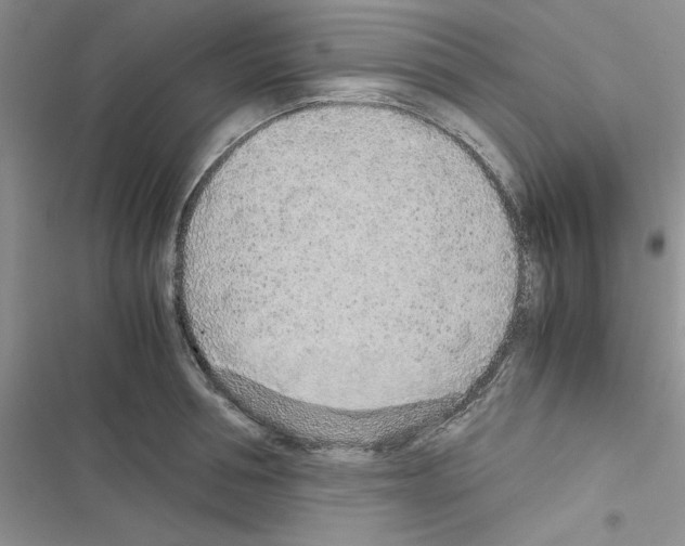 X0000116620994201001221336