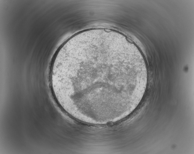 X0000116620997201001221336