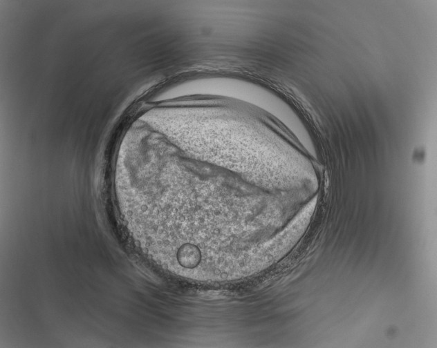 X0000116630396201001081257